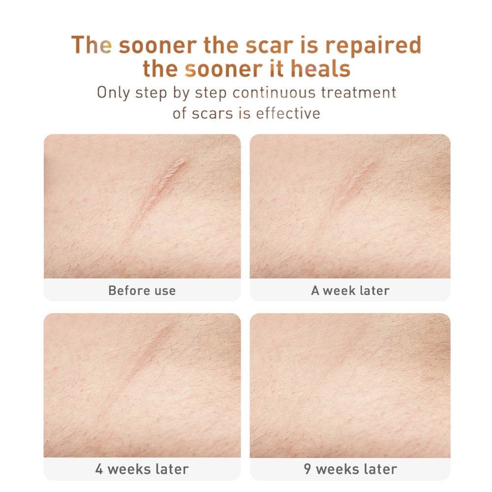 Traditional Chinese Medicine Scar Removal Cream Care Cream Skin Care Products - Ultim8 Designs 4 U